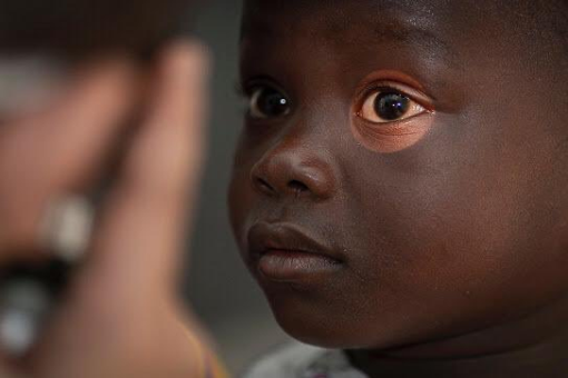 الحملة الطبية التطوعية لمكافحة العمى في السنغال